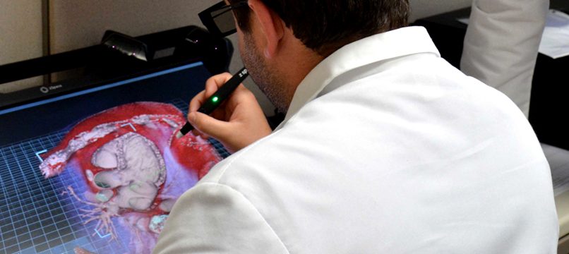 Physician Using Echo Pixel System